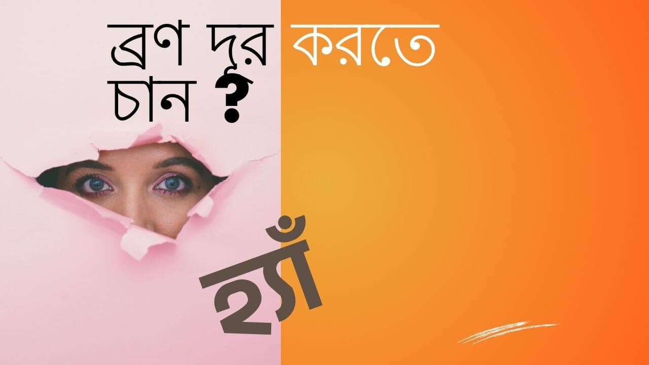 Image-brn-hwar-karn-ki